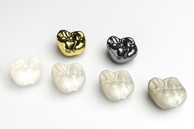 
	How Important is Your Choice of Dental Crown Material?
 Huntington Beach